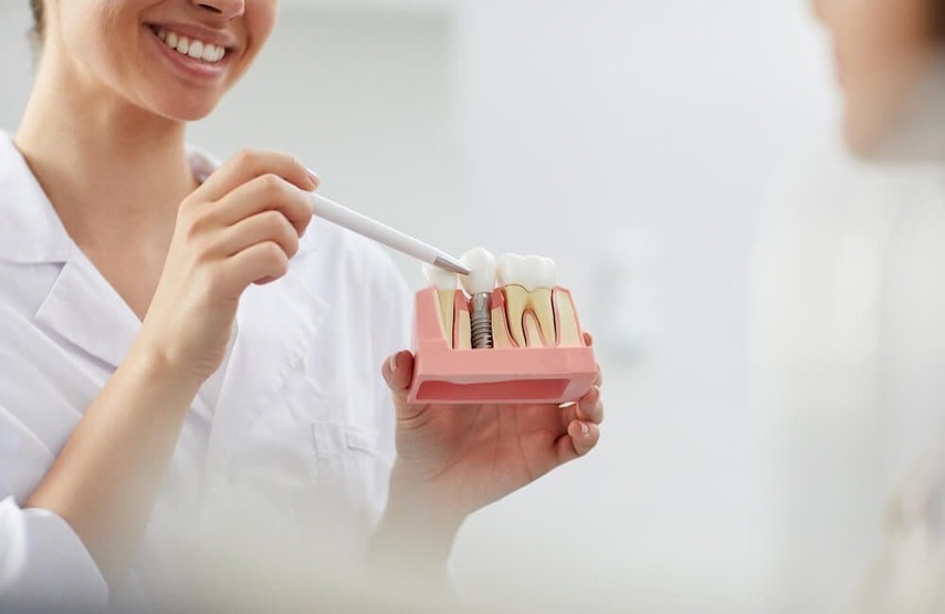 Se me ha caído un implante dental: ¿qué hago?
