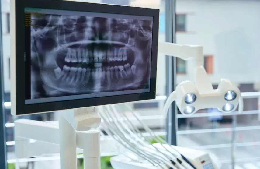 ¿Puedo ponerme implantes dentales si me falta hueso?